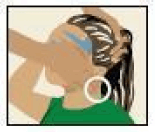 Be sure to apply ULESFIA Lotion to the back of your neck. - Illustration