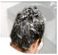 Correct application of ULESFIA Lotion. - Illustration