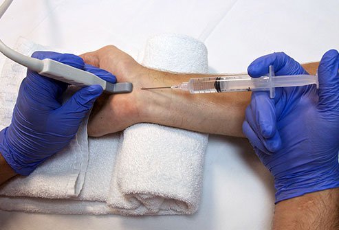 An ulnar nerve block is an injection of anesthesia to numb parts of the hand for surgery.