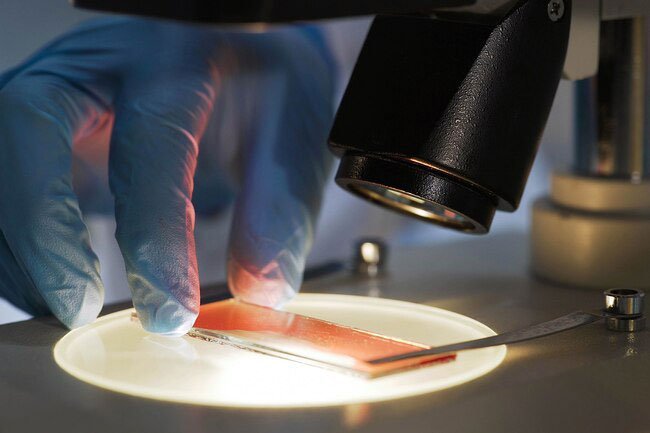 Platelet cells help heal wounds and stop bleeding.