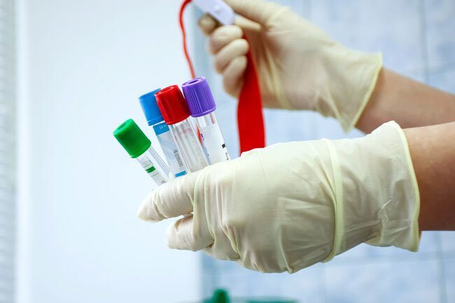 Complete blood count checks different blood components