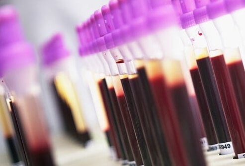 It can be challenging for doctors to diagnose lupus.