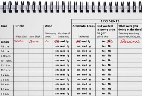 Your doctor might ask you to keep a fluid chart or bladder diary.