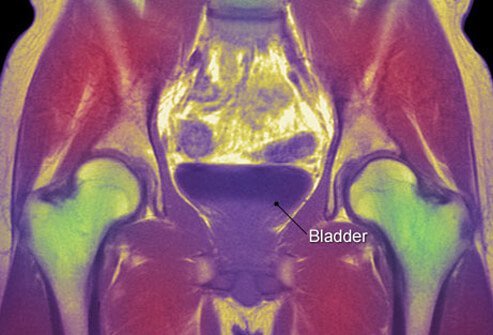 You may be referred to a urologist or a urogynecologist for more specialized testing.