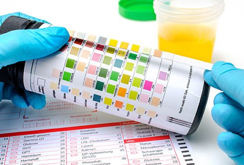 Doctors may have many reasons to study your urine.