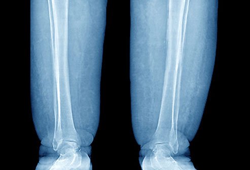 Kidney injuries can be tested through urinalysis.