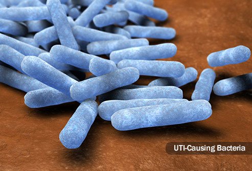 Most UTIs are caused by bacteria.