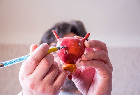 A urodynamic test usually takes about 30 minutes.
