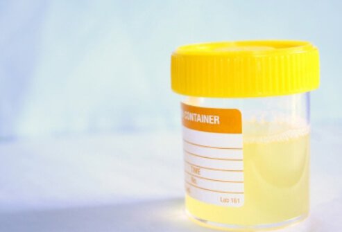 A UTI may be associated with a change in the appearance and odor of urine.