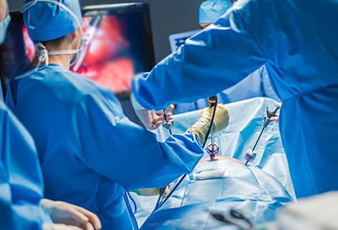 A video-assisted thoracoscopic surgery (VATS) is a minimally invasive thoracic surgery that provides adequate visualization despite limited access to the thorax.