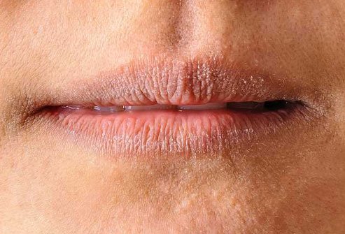 Your mouth could be a good place to spot any shortage of B6.