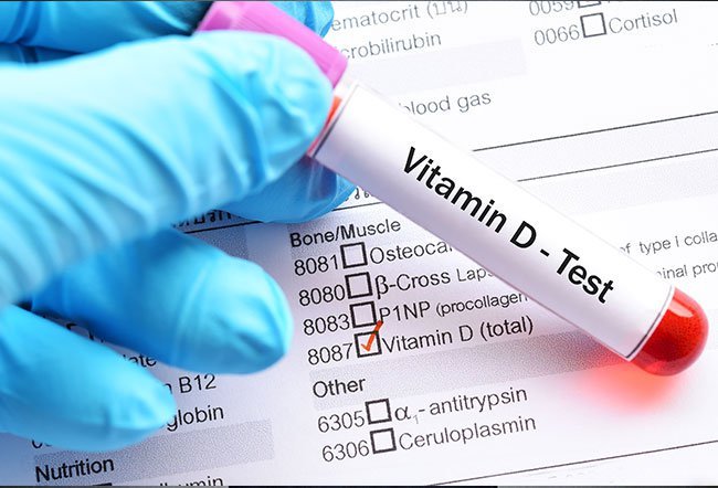 Vitamin D is a fat-soluble vitamin that helps you absorb calcium and build strong bones. The vitamin D test determines your vitamin D levels from a sample of blood drawn from your vein. 