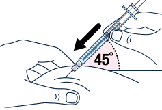 Quickly insert the needle all the way into the skin <b>at a 45-degree
angle - Illustration