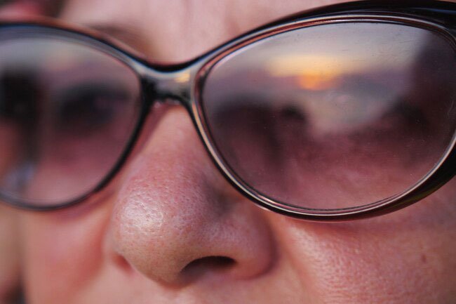 When you squint, you crinkle up the skin on your face, which over time can lead to lines and wrinkles.