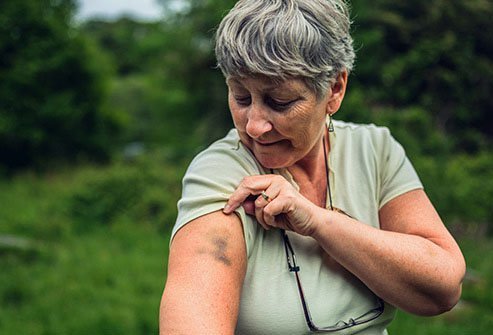 Older adults may notice that they bruise more easily.