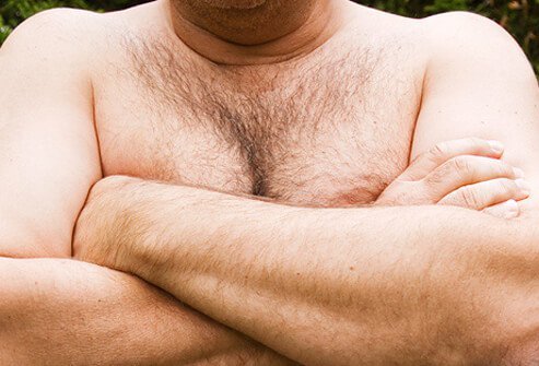 Gynecomastia is usually caused by normal changes in hormone levels at birth, puberty, and later in life.