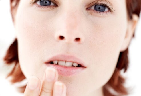 Canker sores are small ulcers inside the mouth.