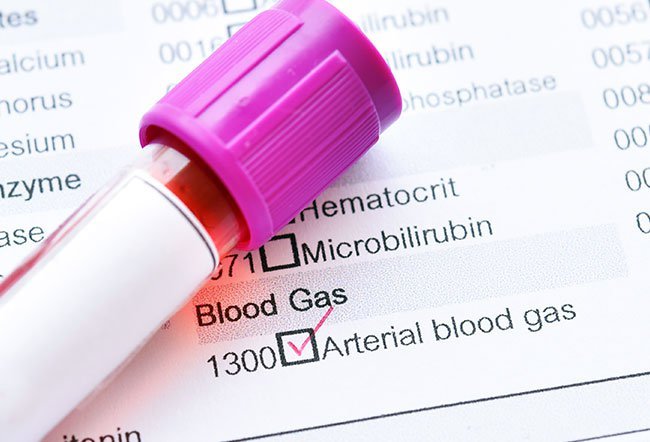 There are primarily two ways your blood oxygen percentage is measured.
