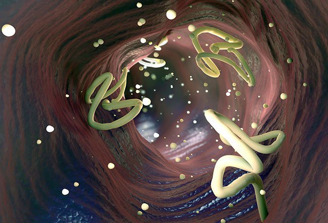 Worm infestation occurs in humans when parasitic worms, also known as intestinal worms, live and grow inside the body. 
