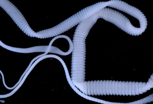 If you have tapeworms, you may not have any symptoms. You may also notice symptoms such as: nausea or diarrhea, abdominal pain, hunger or loss of appetite, fatigue and weakness, weight loss, vitamin and mineral deficiencies, and tapeworm segments visible in your bowel movements.