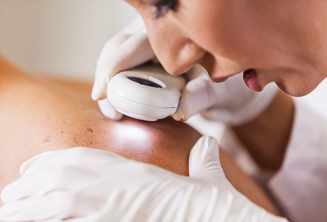 what are the types of skin lesions?