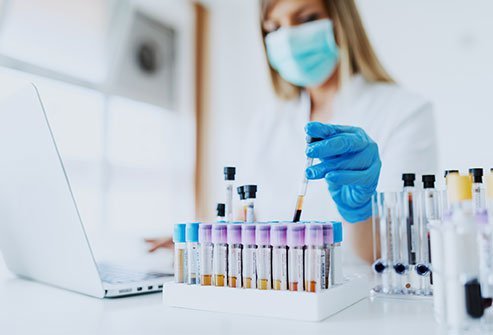The four stages of HIV are categorized by a blood count test of a certain type of immune cells called CD4+. The lower these levels fall, the worse your infection. Ultimately, the count may drop so low it's classified as AIDS, stage 4 of HIV.