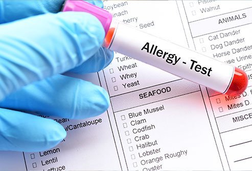 Allergists recognize four types of allergic reactions: Type I or anaphylactic reactions, type II or cytotoxic reactions, type III or immunocomplex reactions and type IV or cell-mediated reactions.