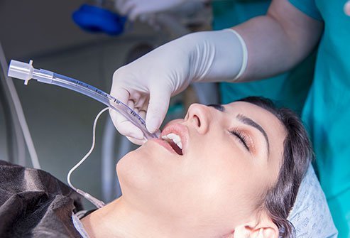Nasotracheal Intubation