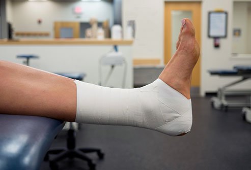 Ankle taping and bracing provides stability to the ankle joint doing vigorous athletic activity; whether to protect the joint from injury or to stabilize and existing injury.