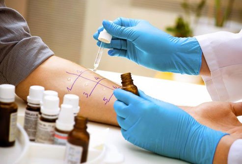Allergens can cause allergic reactions upon skin contact, when they are breathed, swallowed or injected.