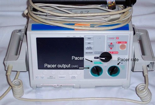 Transcutaneous cardiac pacing (TCP) temporarily paces a patient's heart during an emergency and stabilizes them.