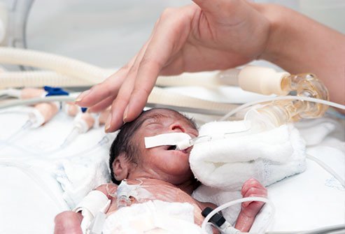 A birth defect is a health condition that is present since birth.