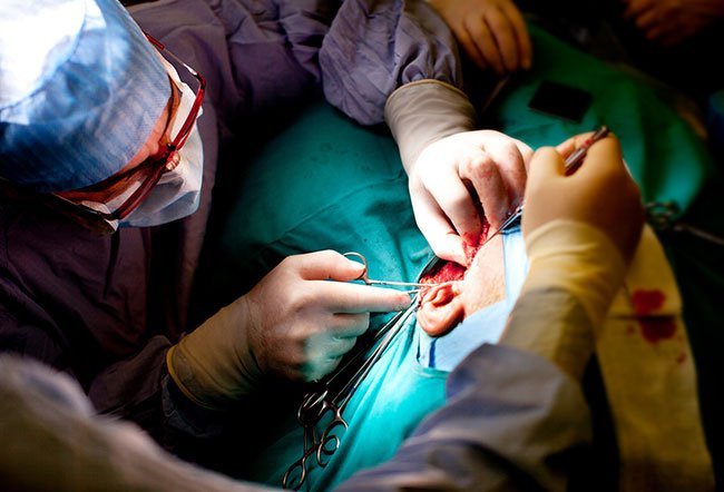 Neck dissection surgery