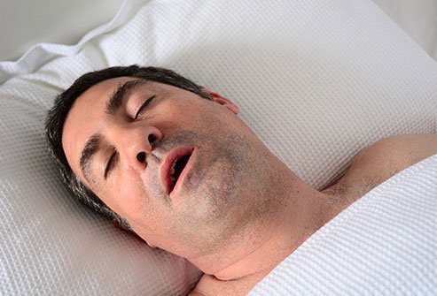 Snoring is just one of many bad breath causes.