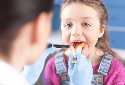 Abscessed Tooth 