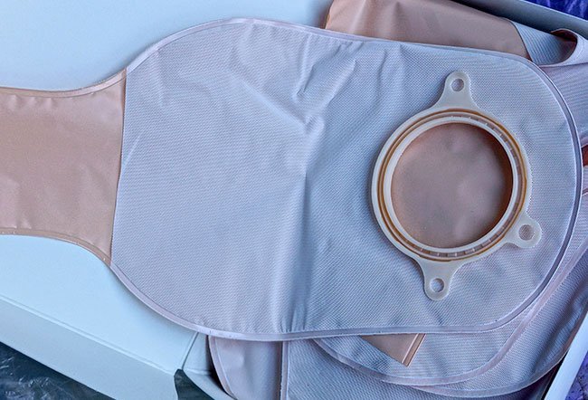 A colostomy is a surgery where an opening is made from the colon out through the abdomen allowing stools to pass out through the abdomen instead of passing through the bowels and rectum. A colostomy is a surgery where an opening is made from the colon out through the abdomen allowing stools to pass out through the abdomen instead of passing through the bowels and rectum.