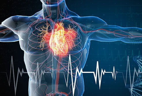 Congestive Heart Failure (CHF)