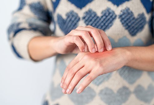 Pain usually starts in the arm or leg and may spread to other body parts. Pain usually starts in the arm or leg and may spread to other body parts.