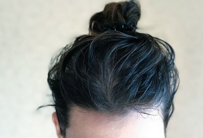 what causes greasy hair