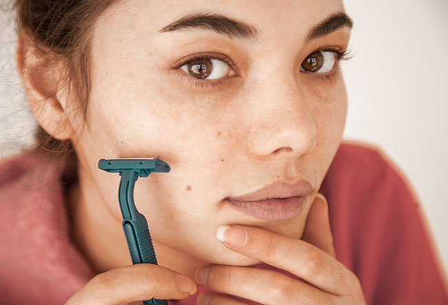 The main cause of hirsutism in females is androgens