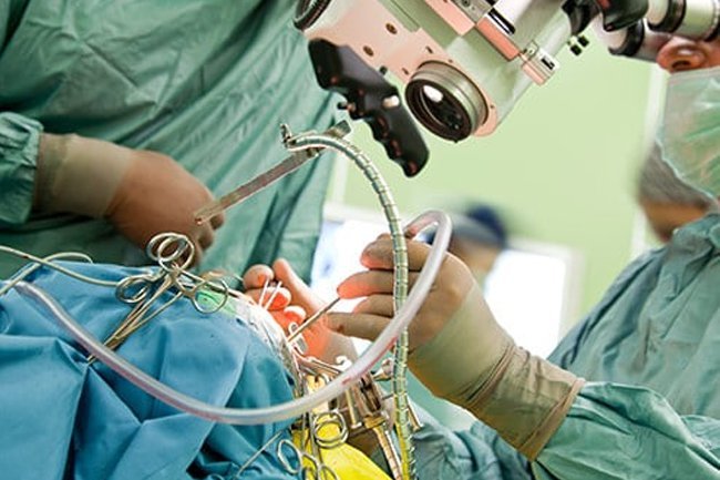 There are several surgical treatment options for brain cancer.