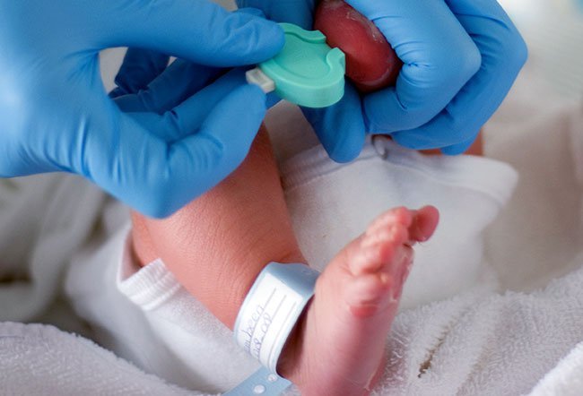 Phenylketonuria PKU Test