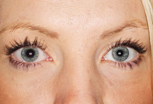 Anisocoria is a term that means the pupils are not the same size.