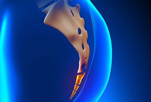 Coccygectomy