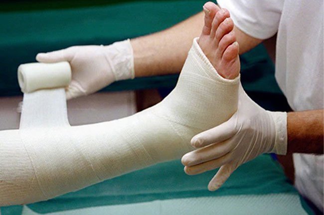 Treating a bone break involves lining it up, immobilizing it while it heals and managing the pain.