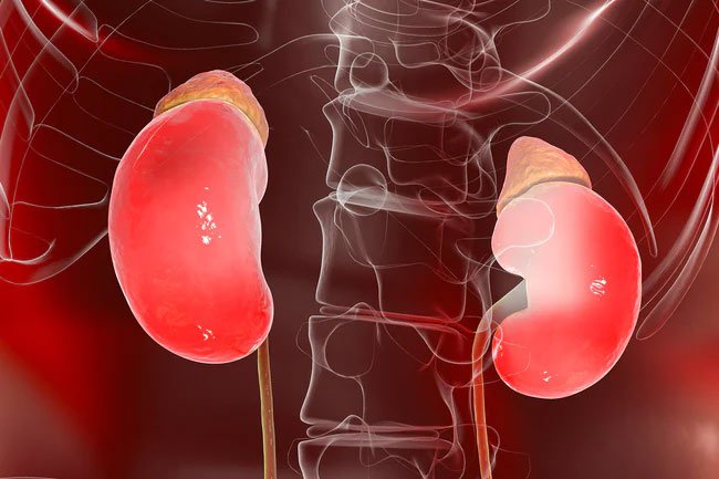 Ketosis may increase uric acid levels, leading to kidney stones or gout flares.