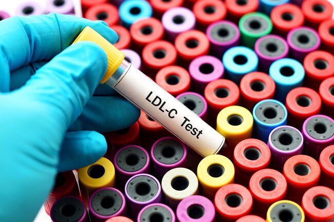 Experts say saturated fats should make up less than 10% of your calories every day.