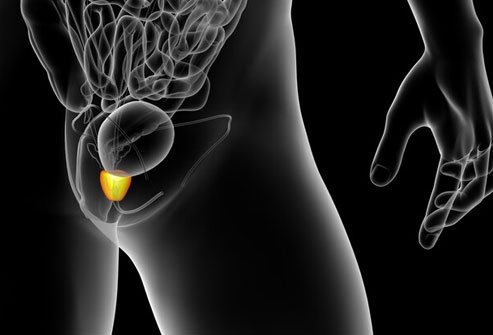 Men who ejaculated less than seven times a month were more likely to get prostate cancer.