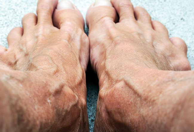 Venous cutdown procedure