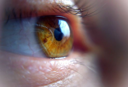 Pneumatic retinopexy is one of the surgical treatments to repair a detached retina and restore vision. 